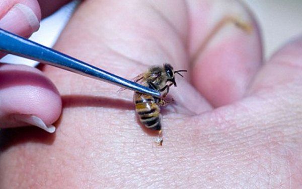 liječenje pčelinjim otrovima za artrozu